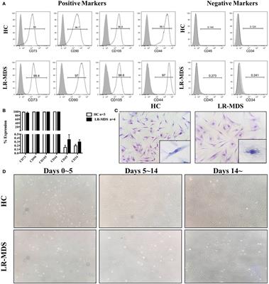 Impaired Expression of Focal Adhesion Kinase in Mesenchymal Stromal Cells from Low-Risk Myelodysplastic Syndrome Patients